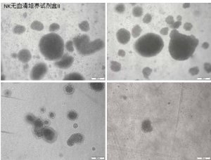 使用Corning? NK細(xì)胞無血清培養(yǎng)試劑盒II 高效地激活和擴增人類自然殺傷細(xì)胞 應(yīng)